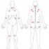 Puntos de dolor para identificar la fibromialgia